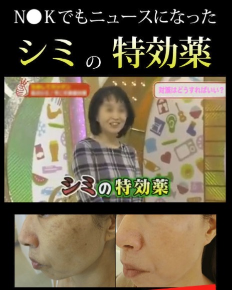 シアウールは芸能人も愛用!雑誌やメディアで人気